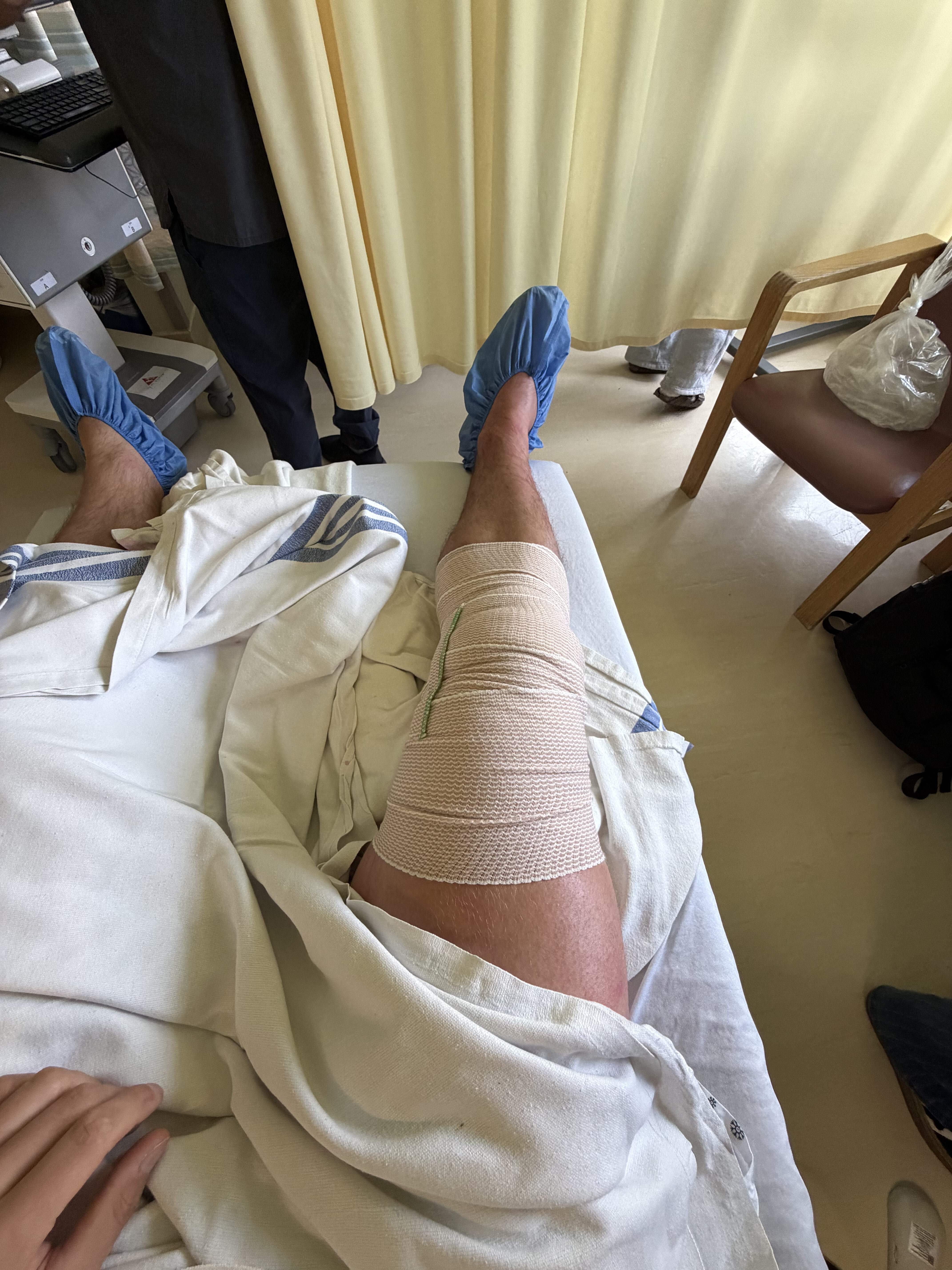 Fresh out of the operation