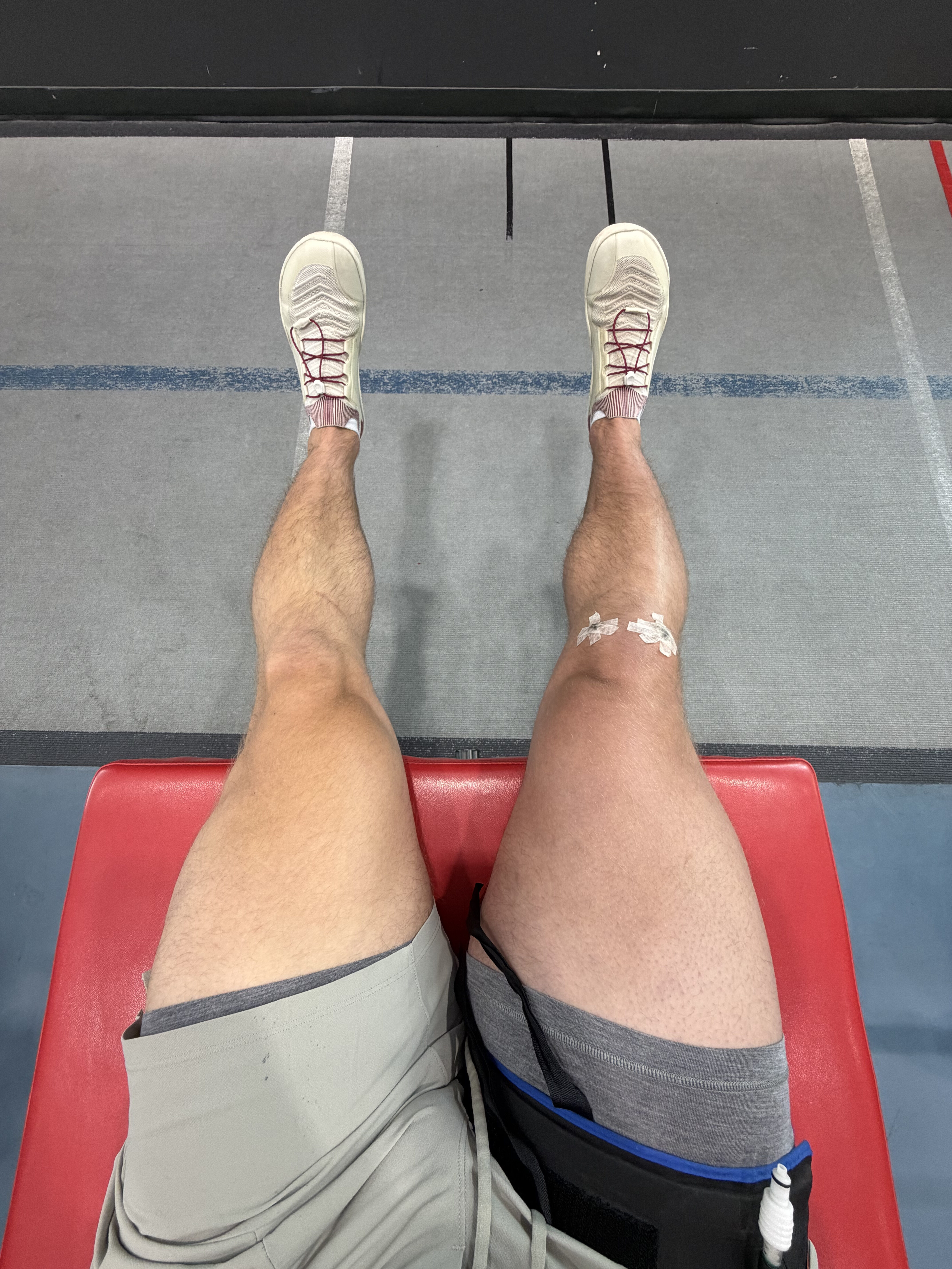 Back in the gym with the steri-strips still on